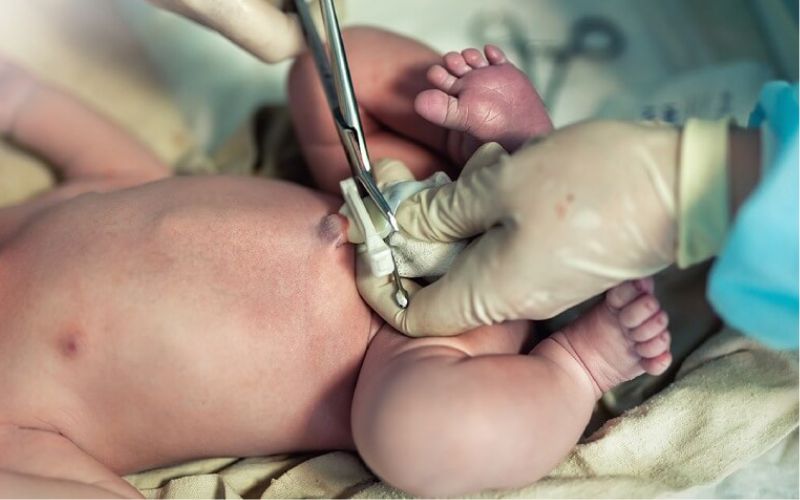 Lưu trữ tế bào gốc cuống rốn là loại tế bào được lấy từ màng dây rốn của trẻ sơ sinh ngay sau khi sinh