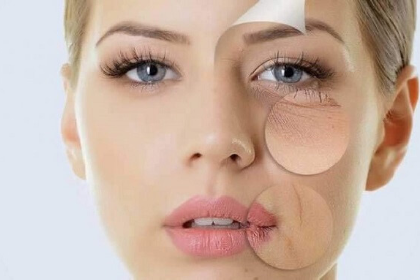 Người lo lắng về da chảy xệ và nếp nhăn